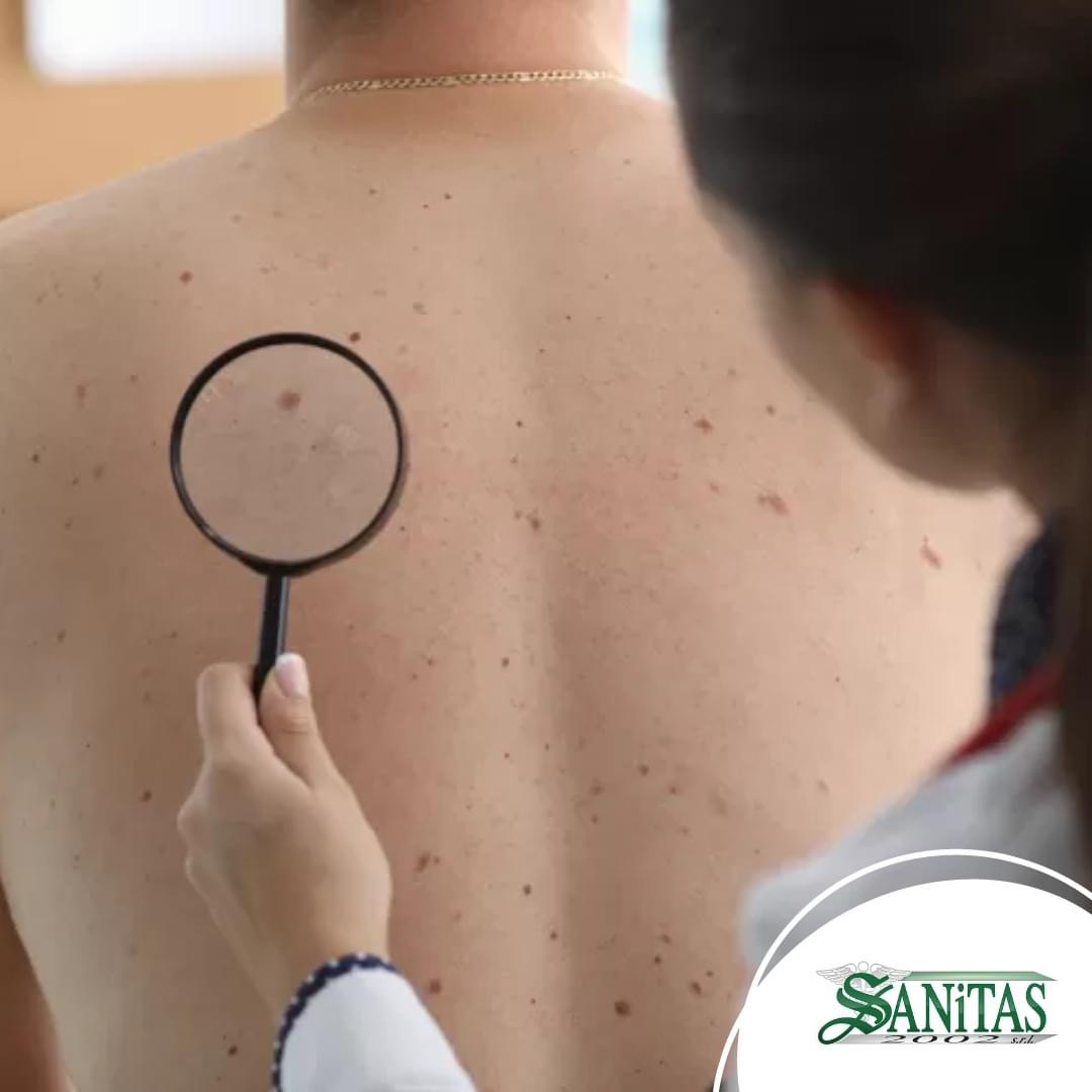 https://www.agenziaeventi.org/immagini_news/4512/sanitas-2002-srl-prenota-ora-la-tua-visita-dermatologica-4512.jpg